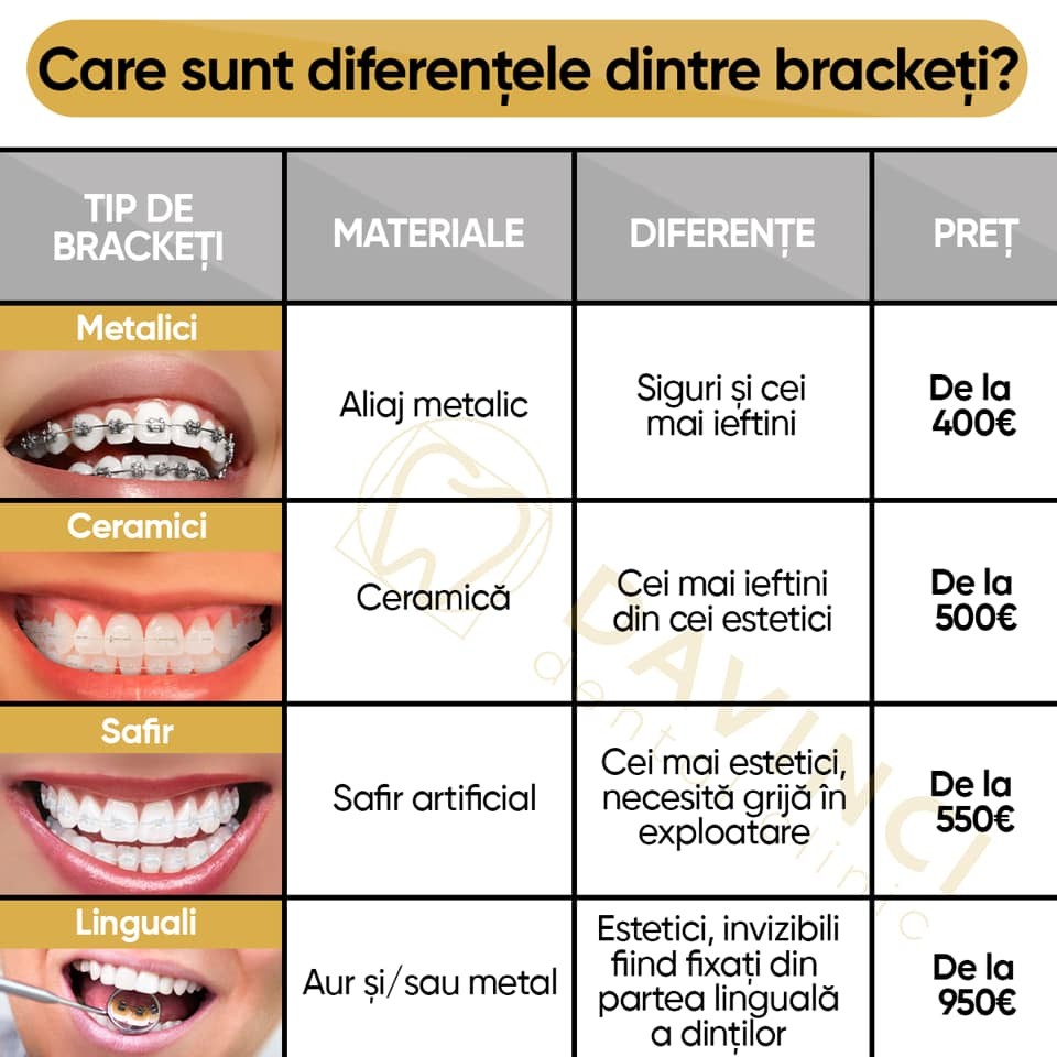 pretul bracheti, tratament ordontie dentara la Davinci